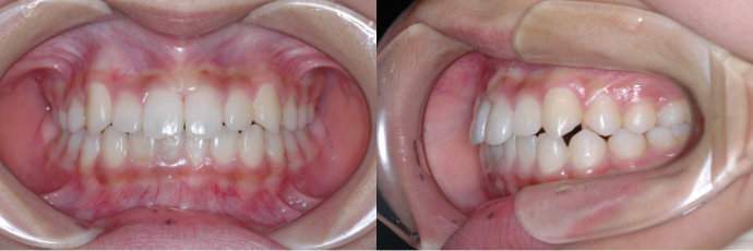 ȿ������2