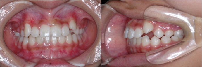 ȿ������2