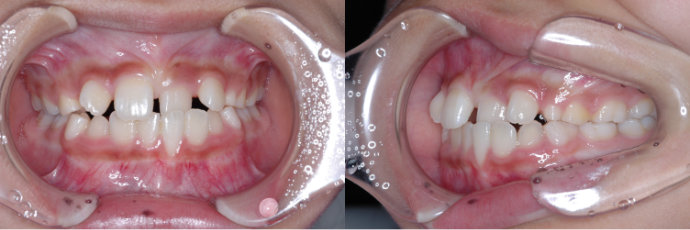 ȿ������2