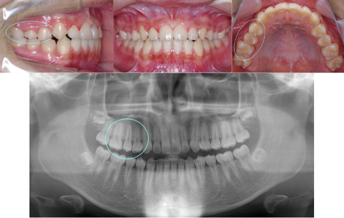 ȿ������2