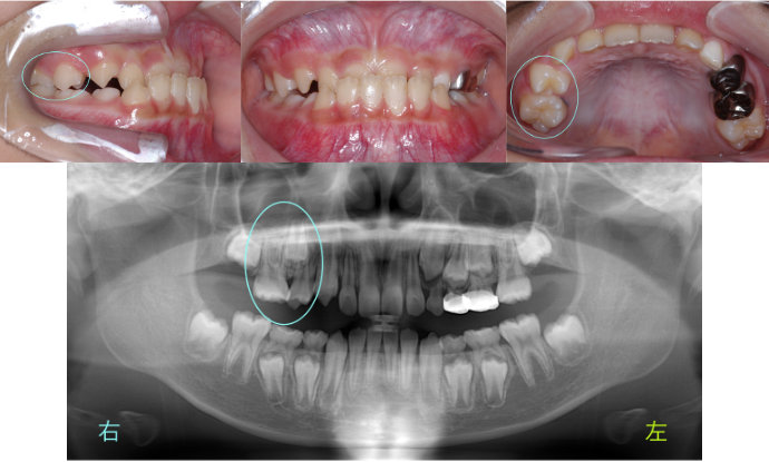 ȿ������2