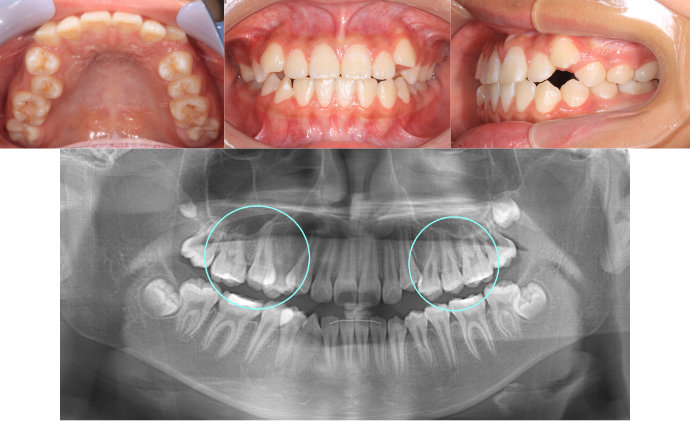 ȿ������2