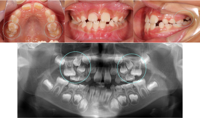 ȿ������2