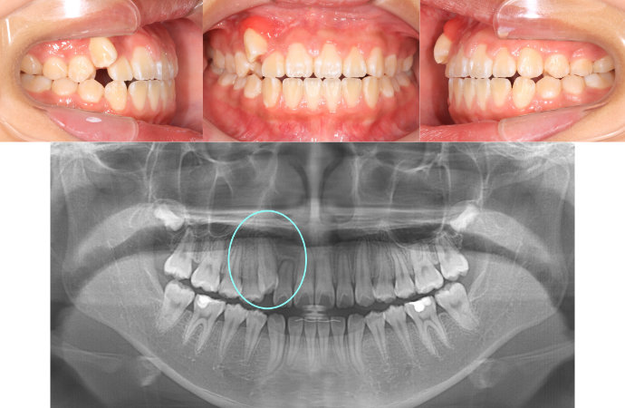 ȿ������2