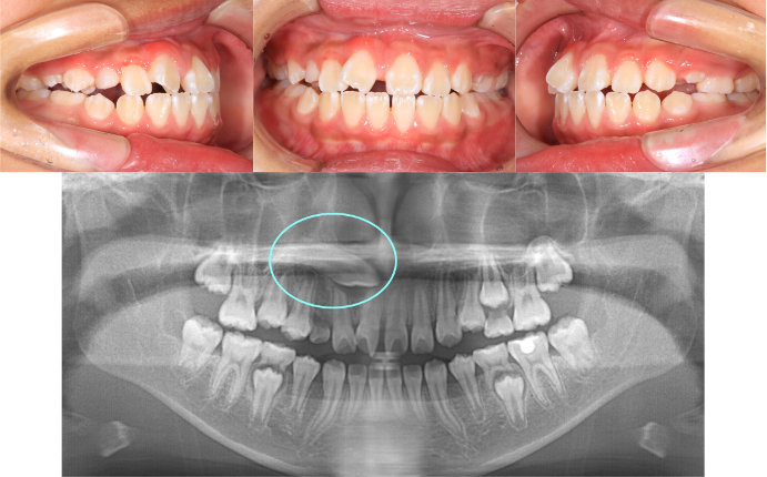 ȿ������2