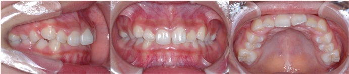 ȿ������2