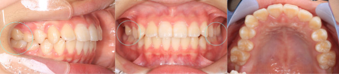 �Ϥ��߾�����1