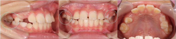 �Ϥ��߾�����1