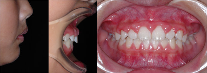 �������1