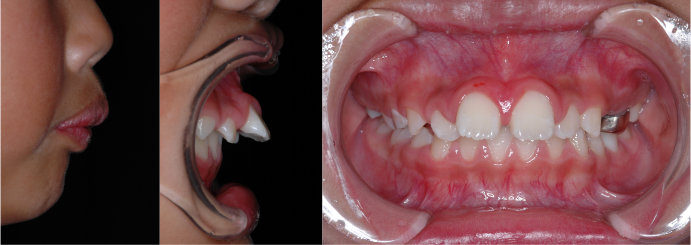 �������1