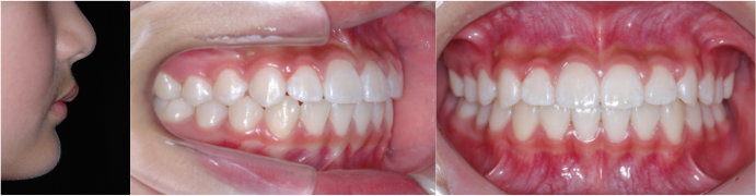 ȿ������1