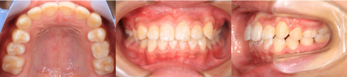 ȿ������1