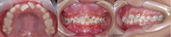 ȿ������1